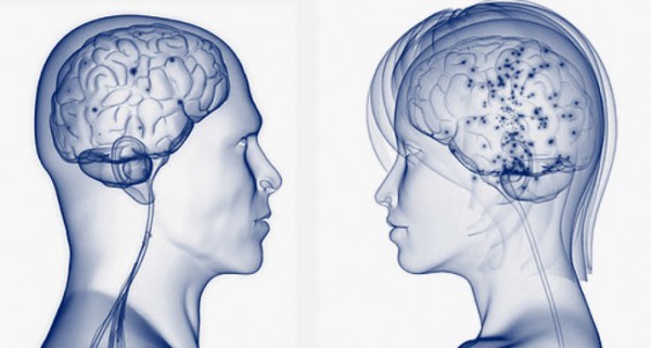 "Общение" отделов мозга между собой происходит по-разному у мужчин и женщин