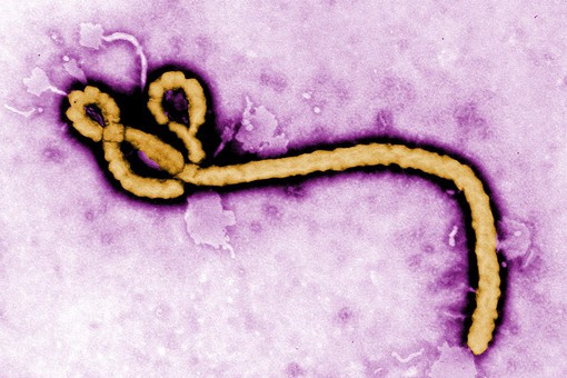 Изучено действие вируса Эбола на клетки человека